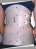 adult-baby,baby,ab/dl,diaper,nappy,couches,infantilisme,diaper lover, travesti,travestie,transvestite,transgender,gender,tranny,trav,transexuelle,transexuel, gag,punition,bondage,spank,spanking, femdom,soumis,domina,dominatrice,esclave,sub,slave,mistress,master, facesitting,baillon,lavement,enema,clyster,platre,caster,cast,casting,canule,sp�culum, corset,cincher,victorien,serre-taille,waist-cincher,ligerie, maid,male-maid,soubrette,servante,domestique,serviteur,menage, mommification,mummification,bondage,rope,film,corde, orthopedie,corset,tlso,lso,ctlso,brace,scoliosis,cyphosis,kafo,hkafo,milwaulkee,boston,lombostat